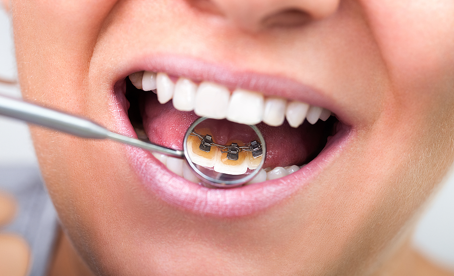 The Importance Of Preventative Dentistry: How Regular Checkups And Cleanings Can Keep Your Smile Healthy