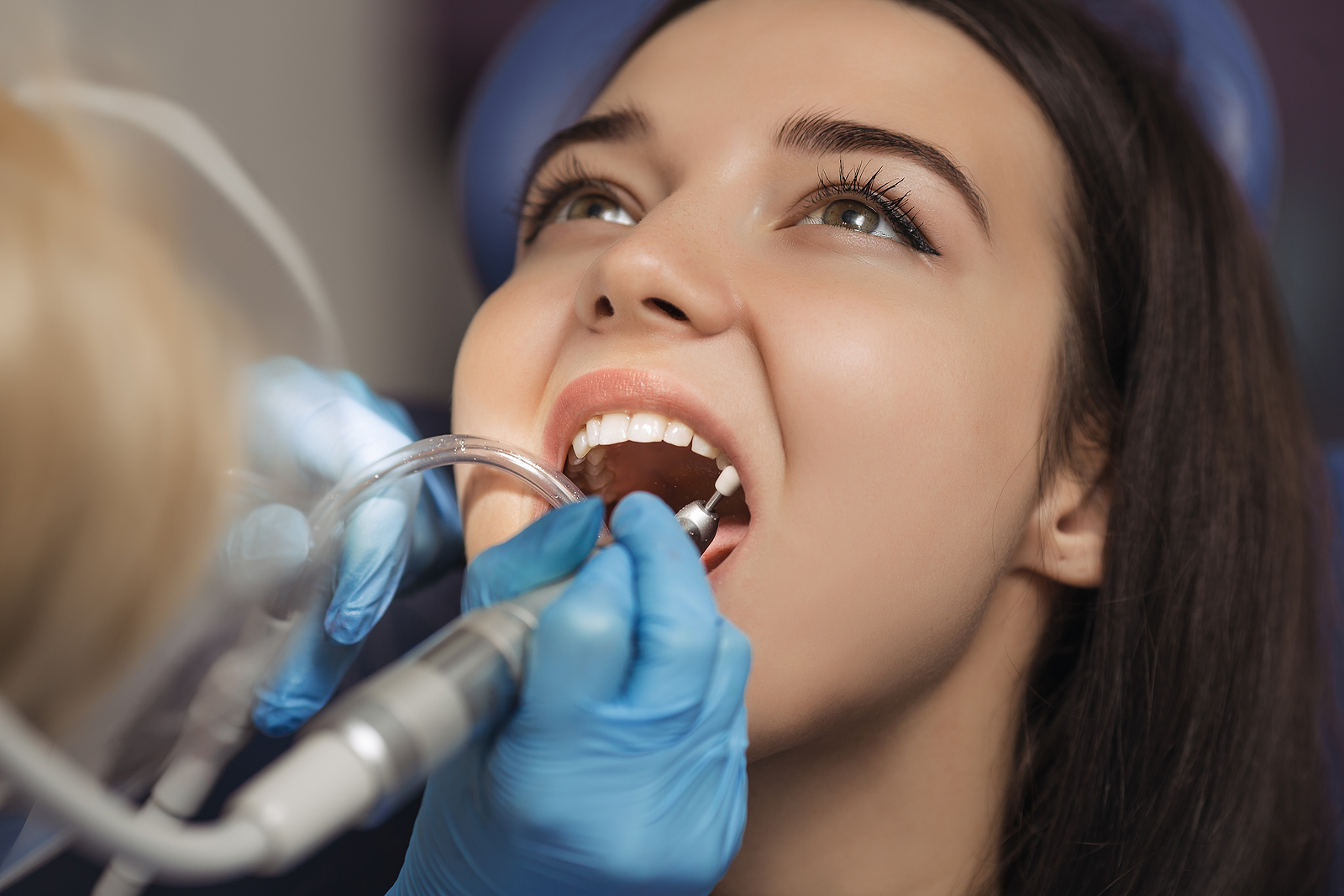 What to Expect After a Root Canal Procedure: A Comprehensive Guide